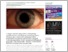 [thumbnail of A száraz szem betegség gyógyítását segíti a Szegedi Tudományegyetemen folyó kutatás – Innoportal.hu.pdf]